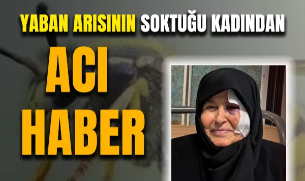 Yaban Arısının Soktuğu Kadından Acı Haber